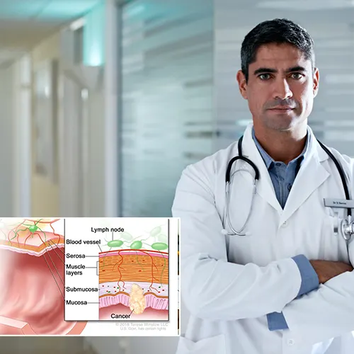 Why Choose  Urology San Antonio

for Your Penile Implant Surgery?